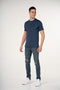 Medium Wash Distressed Skinny Fit Jeans